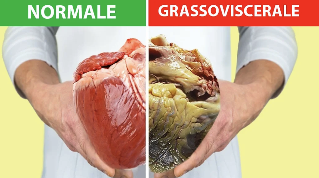 Grasso viscerale accumulato in menopausa a causa del cortisolo alto
